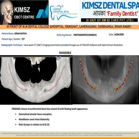 Comprehensive CBCT Analysis for Mandibular Implant Planning and Bone ...