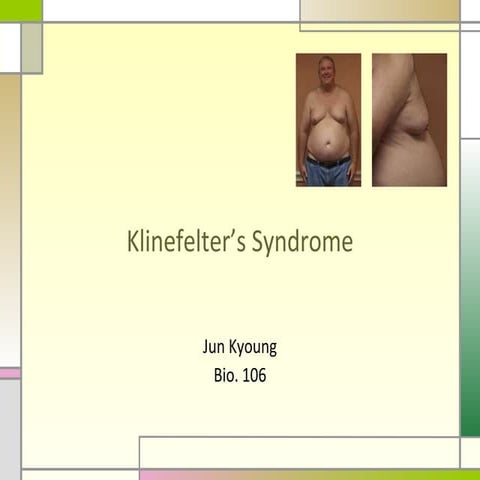 Klinefelter