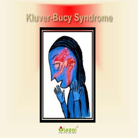 Kluver bucy syndrome