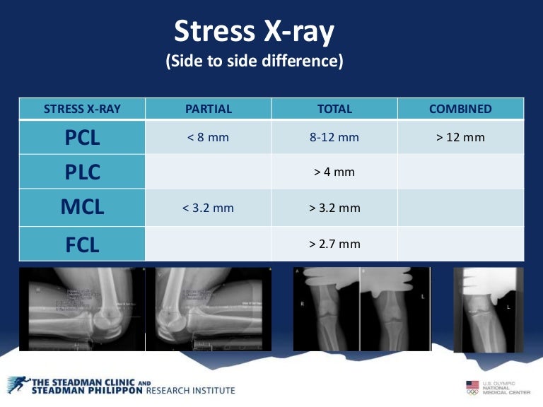Knee Stress XRay Guide