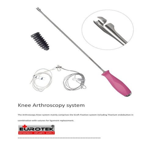 Knee Arthroscopy | PDF