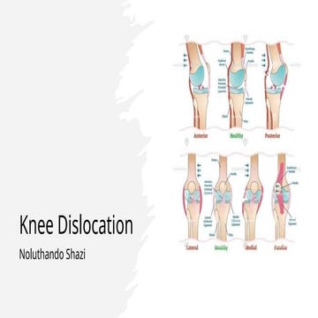 Approach to knee dislocation and how to manage it.pptx