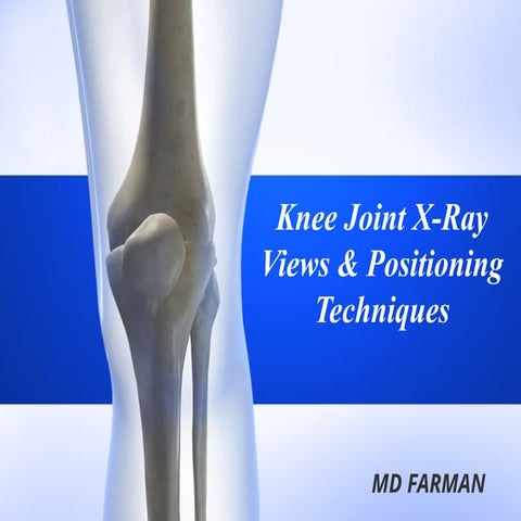 radiography positioning of knee and leg | PPTX