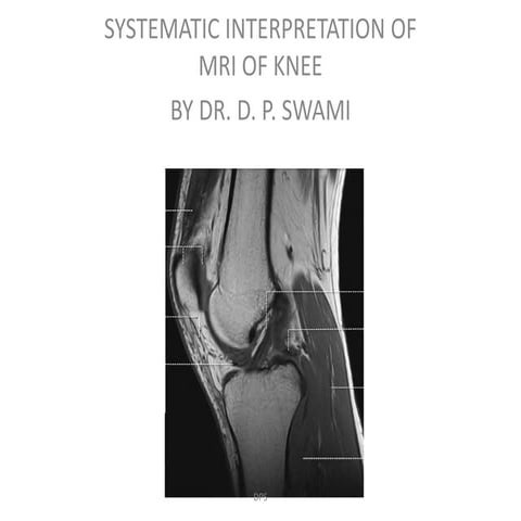 Knee mri: systematic interpretation by dr. d. p. swami