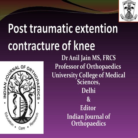 Knee stiffness dr anil k jain