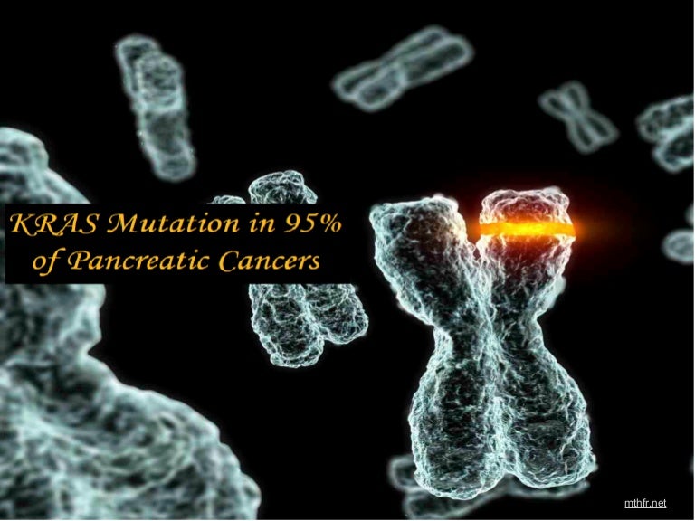 Kras Mutation in 95% of Pancreatic Cancer