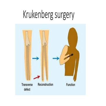 Krukenberg surgery
