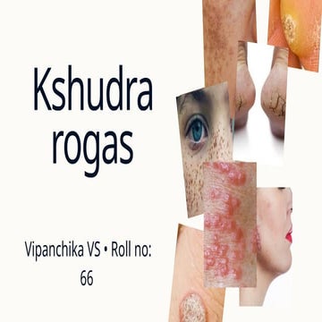 KUSTHA PPT .pdf KUSTHA definition, classification, and modern probable ...