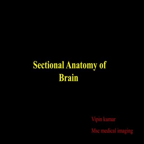 MRI SECTIONAL ANATOMY OF BRAIN 