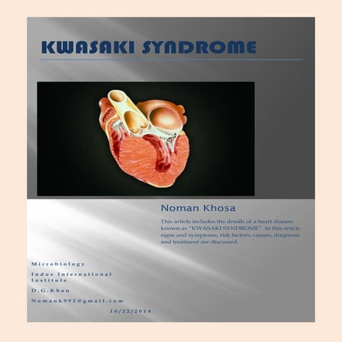 Kwasaki syndrome2