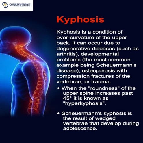 Kyphosis