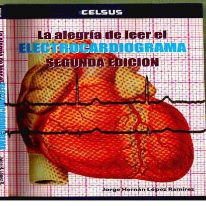 LA ALEGRIA DE LEER EL ELECTROCARDIOGRAMA
