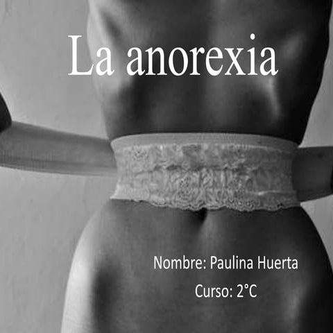 anorexia