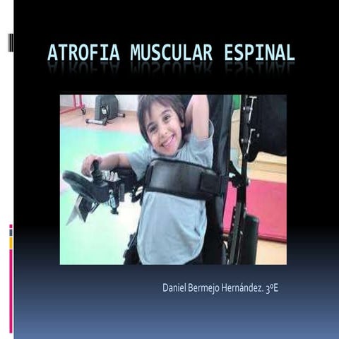 La atrofia muscular