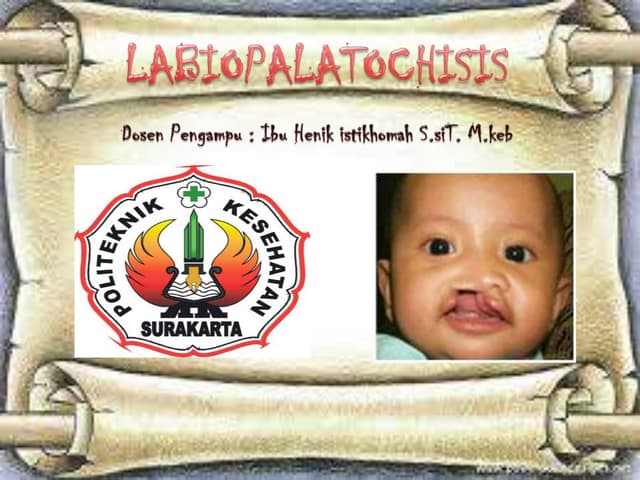 Askep Labiopalatoskisis | DOCX