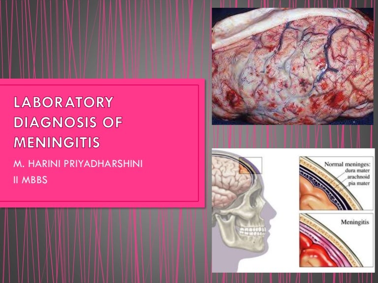 Laboratory diagnosis of meningitis