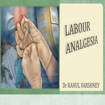 Labour analgesia