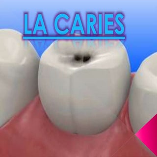 LA CARIES 