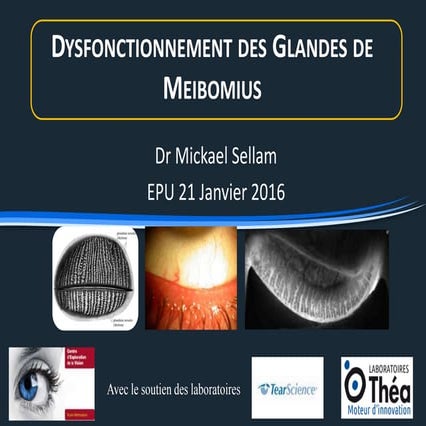 La dysfonction des glandes de Meibomius.pptx