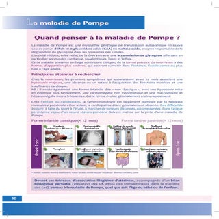 La maladie de pompe.