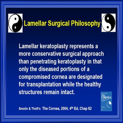 Lamellar surgery