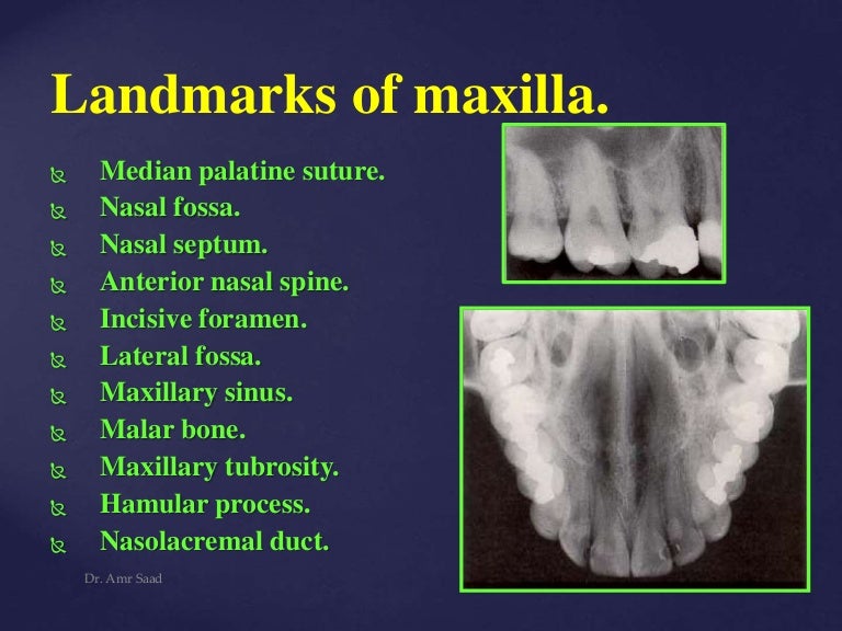 anatomical Landmarks