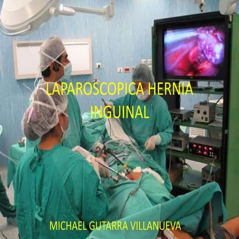 Laparoscopica hernia inguinal ppt.....