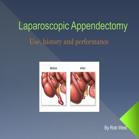 Laparoscopic Appendectomy.ppt
