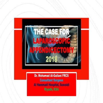 Laparoscopic appendectomy for appendicitis | PPTX