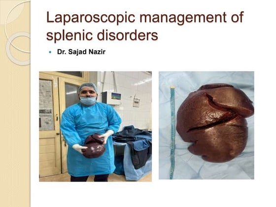 Complications of Splenectomy and Management.pptx