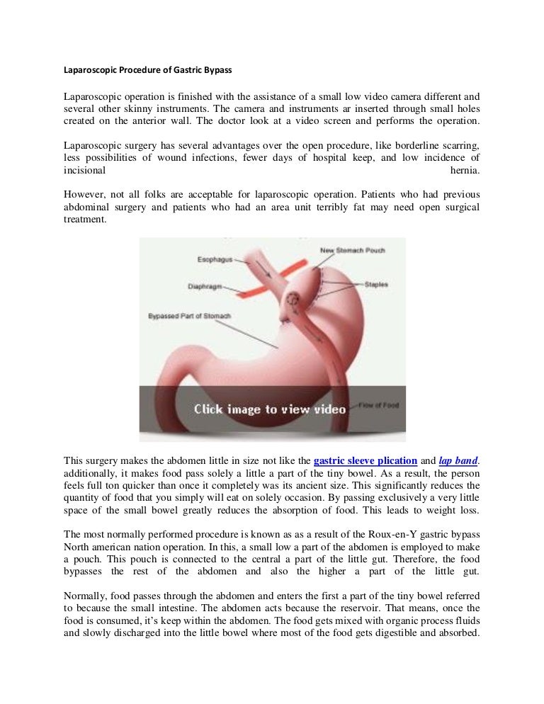 Laparoscopic procedure of gastric bypass