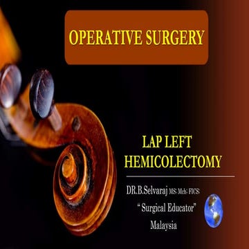 LAP LEFT HEMICOLECTOMY-STEP BY STEP Operative Surgery.pptx