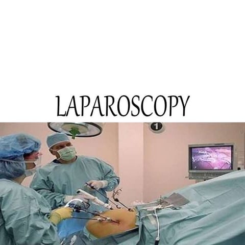 laproscopy-180201094721.pdflaproscopy-180201094721.pdf