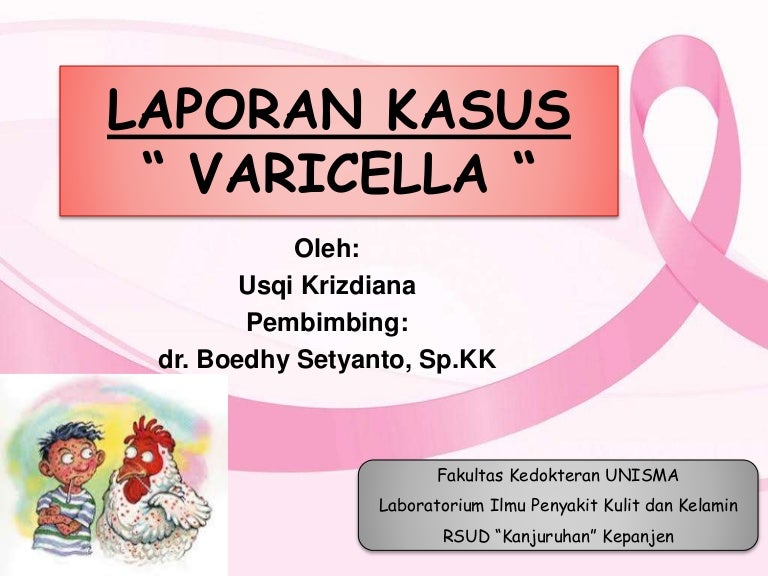 cumparai unguent împotriva varicozei varicoza din festia lui eura