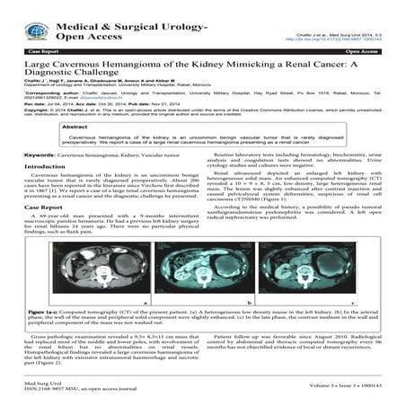 Large Cavernous Hemangioma of the Kidney Mimicking a Renal Cancer: A Diagnostic Challenge
