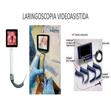 LARINGOSCOPIA VIDEOASISTIDA EN ANESTESIOLOGIA | PPTX