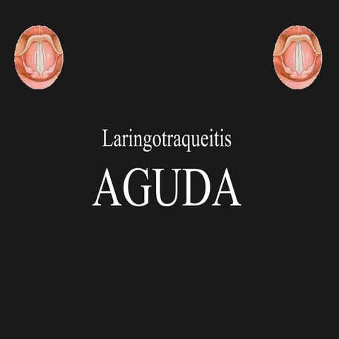 Laringotraqueitis Aguda (CRUP)