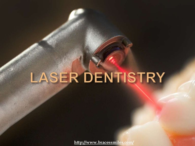 Overview of Laser Dentistry by Braces & Smiles Orthodontic and Dental…