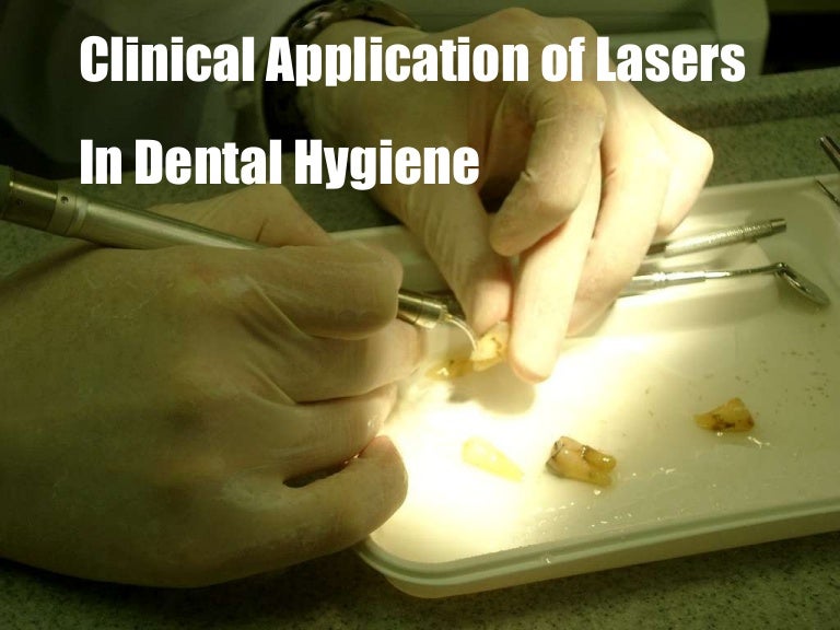 Lasers In Dental Hygiene Powerpoint