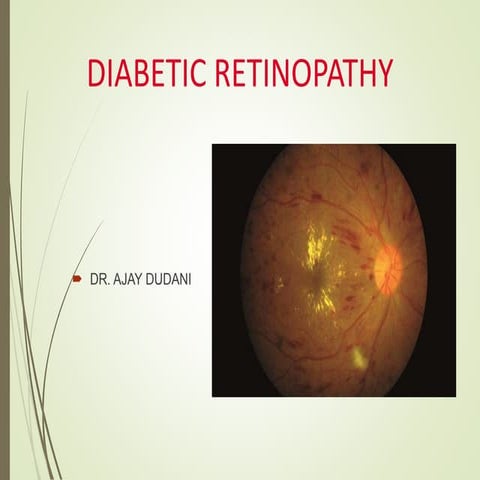 Lasers in DIABETIC RETINOPATHY
