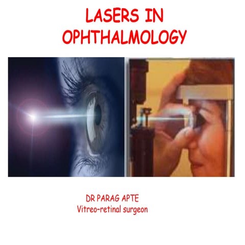 Lasers in ophthalmology - Dr. Parag Apte