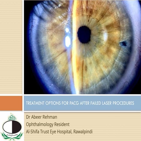 Lasers in Primary Angle Closure Glaucoma.pptx