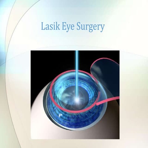 Lasik eye surgery