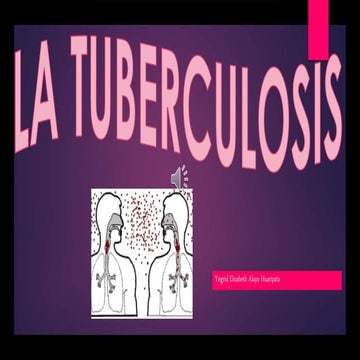 tuberculosis | PPTX