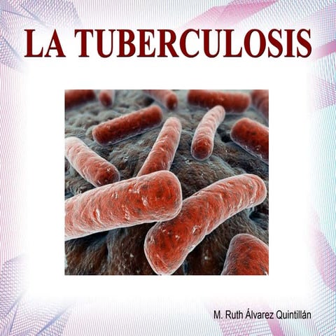 La tuberculosis (presentación power point) | ODP