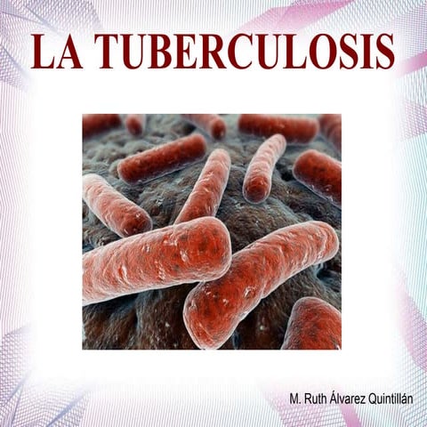 Tuberculosis | PPTX
