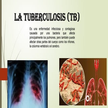 La tuberculosis (TB).pptx (enfermedad ) | PPTX