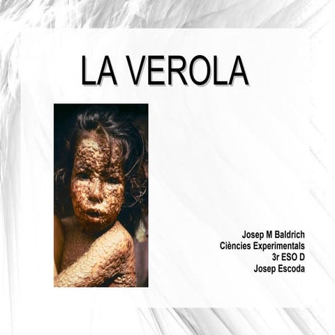 La verola | ODP
