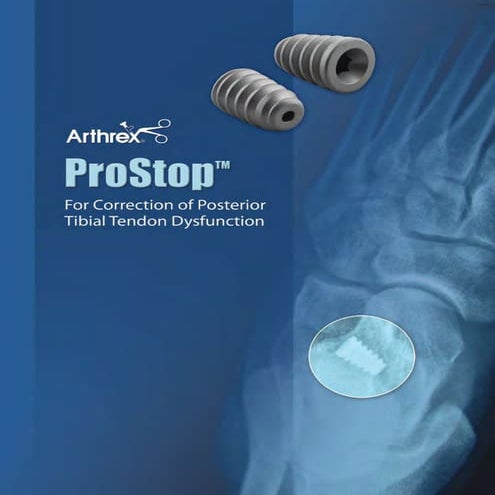 Lb0431 b prostop | PDF