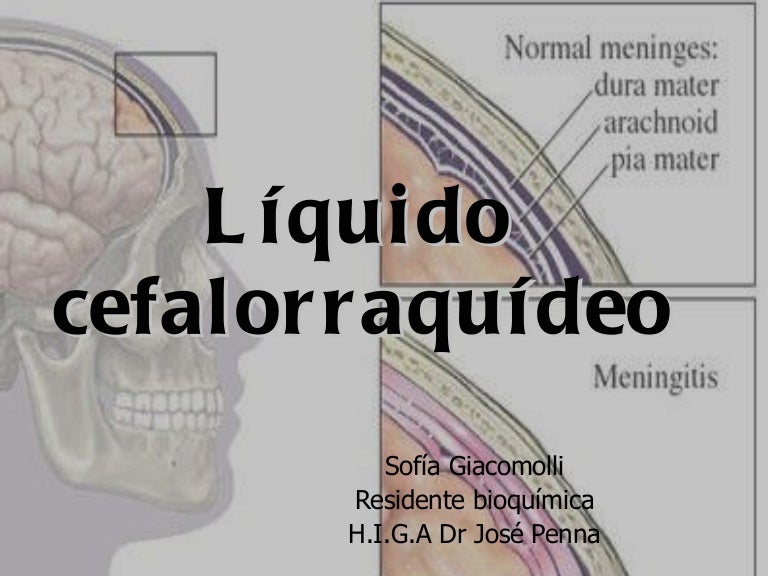 liquido cefalorraquideo sofia